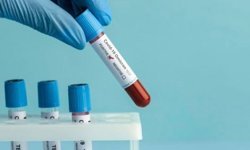 Omicron varyantı hızla yayılıyor!